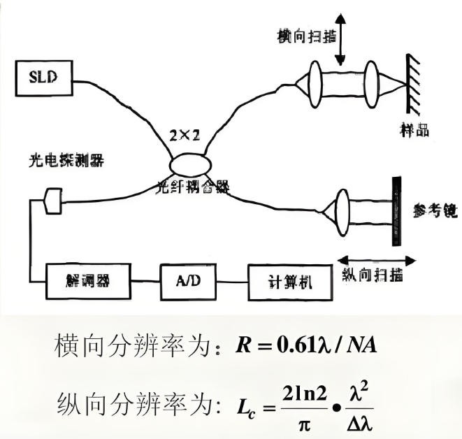 光學相干斷層掃描 光學相干斷層掃描
